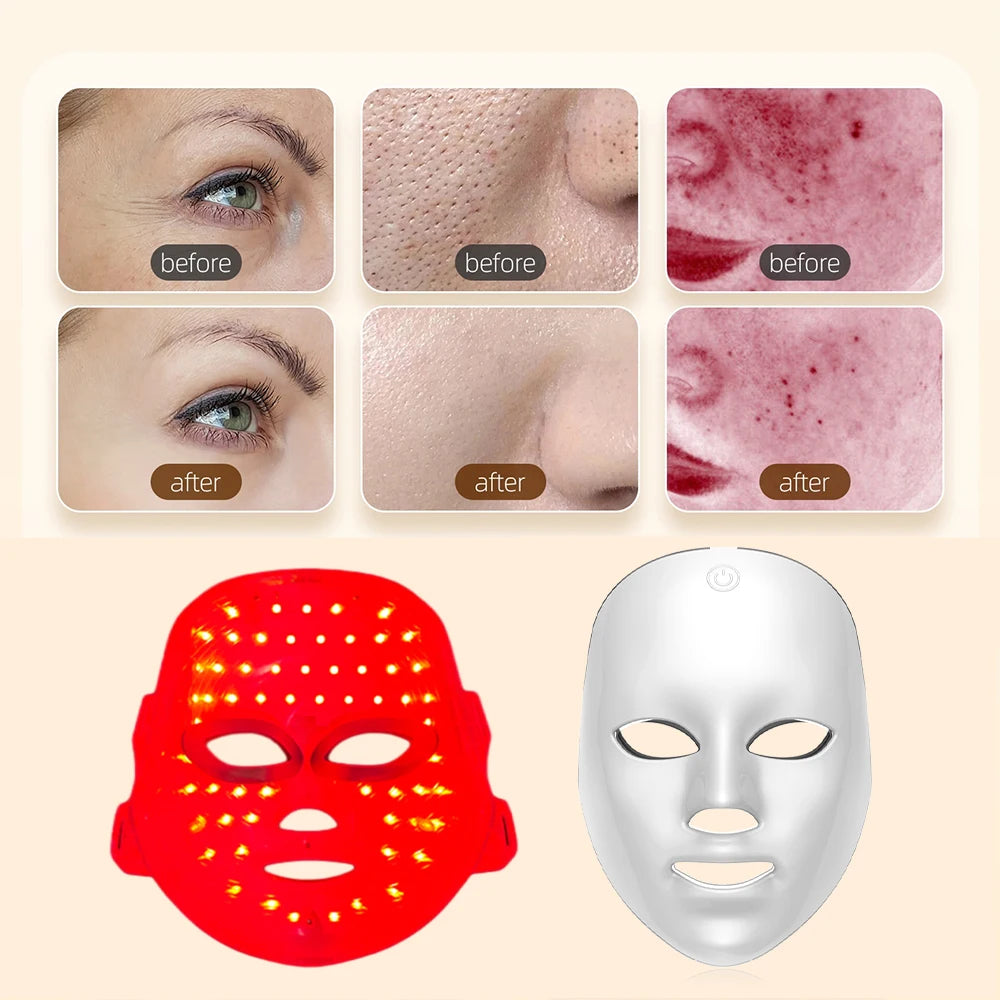 Máscara Facial LED de 7 Colores – Terapia de Luz para Rejuvenecimiento y Cuidado Facial